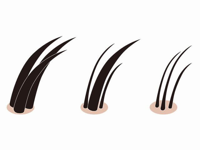 髪の毛が細くなるイメージ